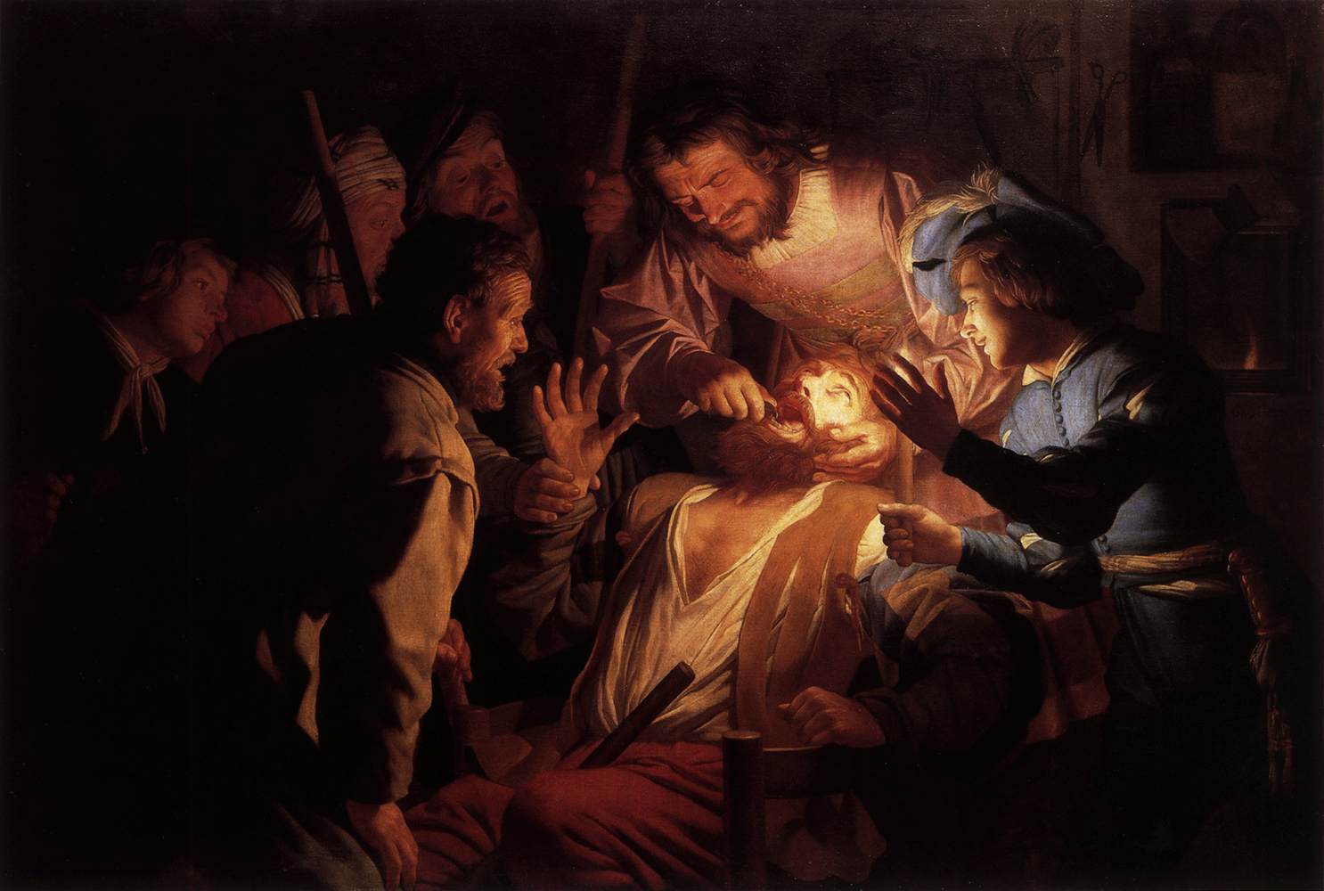 Le dentiste - Gerrit van Honthorst - Alpha Reproduction
